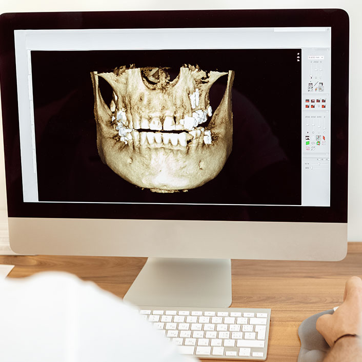 Cone Beam CT Scan Technology