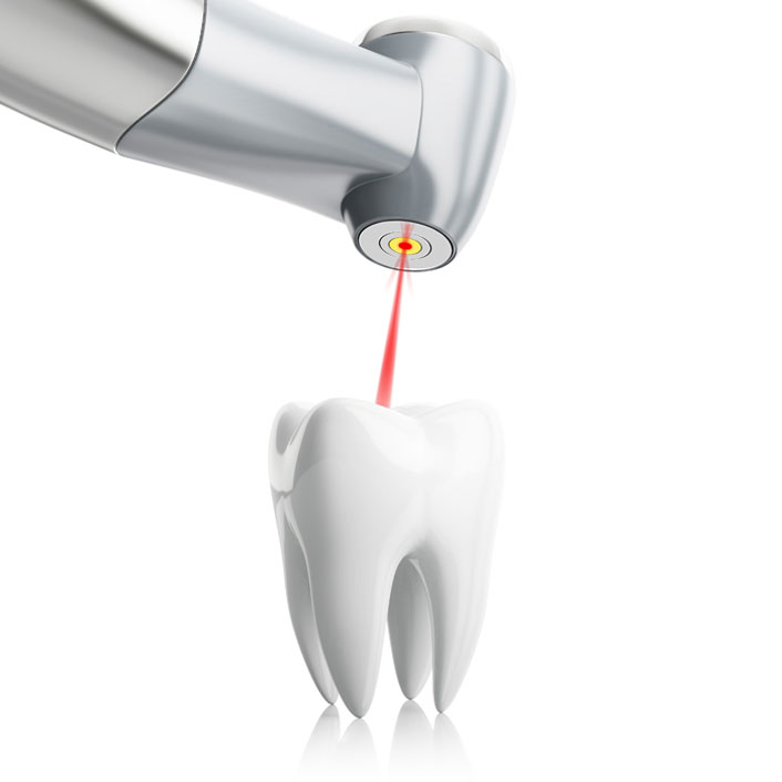 Laser dentistry